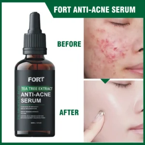 CHAQON Anti Acne Serum – Herbal Extract, Anti-Pimple, Scar Removal